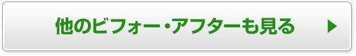 他のビフォー・アフターも見る